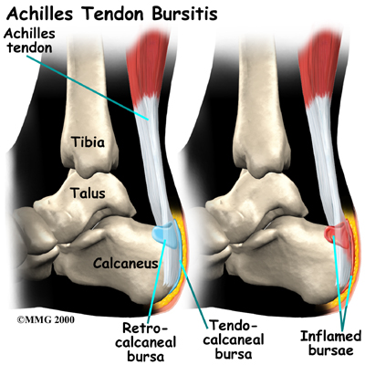 foot_achilles_tendon_anatomy03