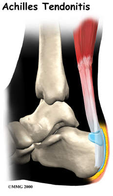 foot_achilles_tendon_anatomy04